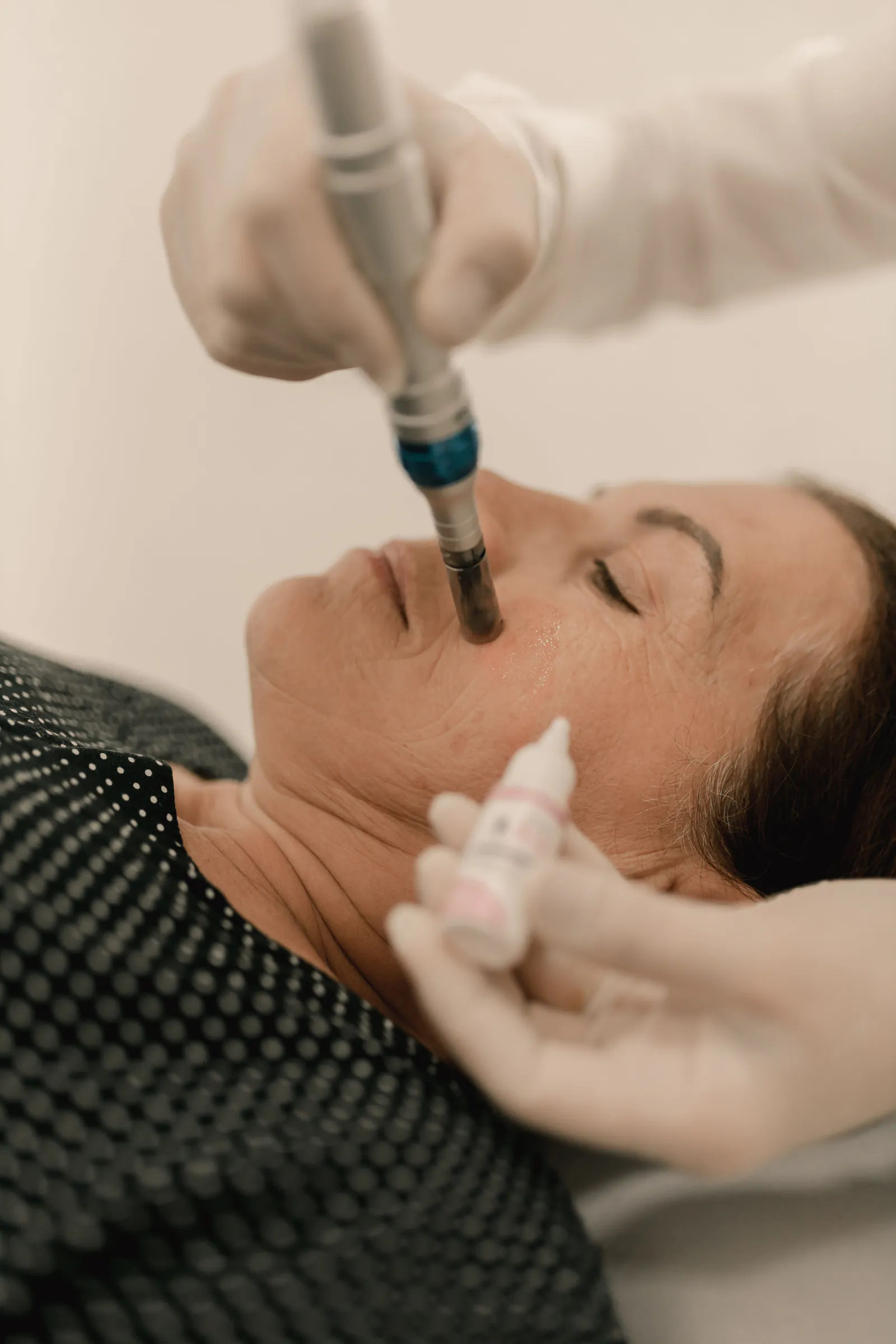 Client receiving a facial treatment with a handheld exfoliation device in a clinical setting.
