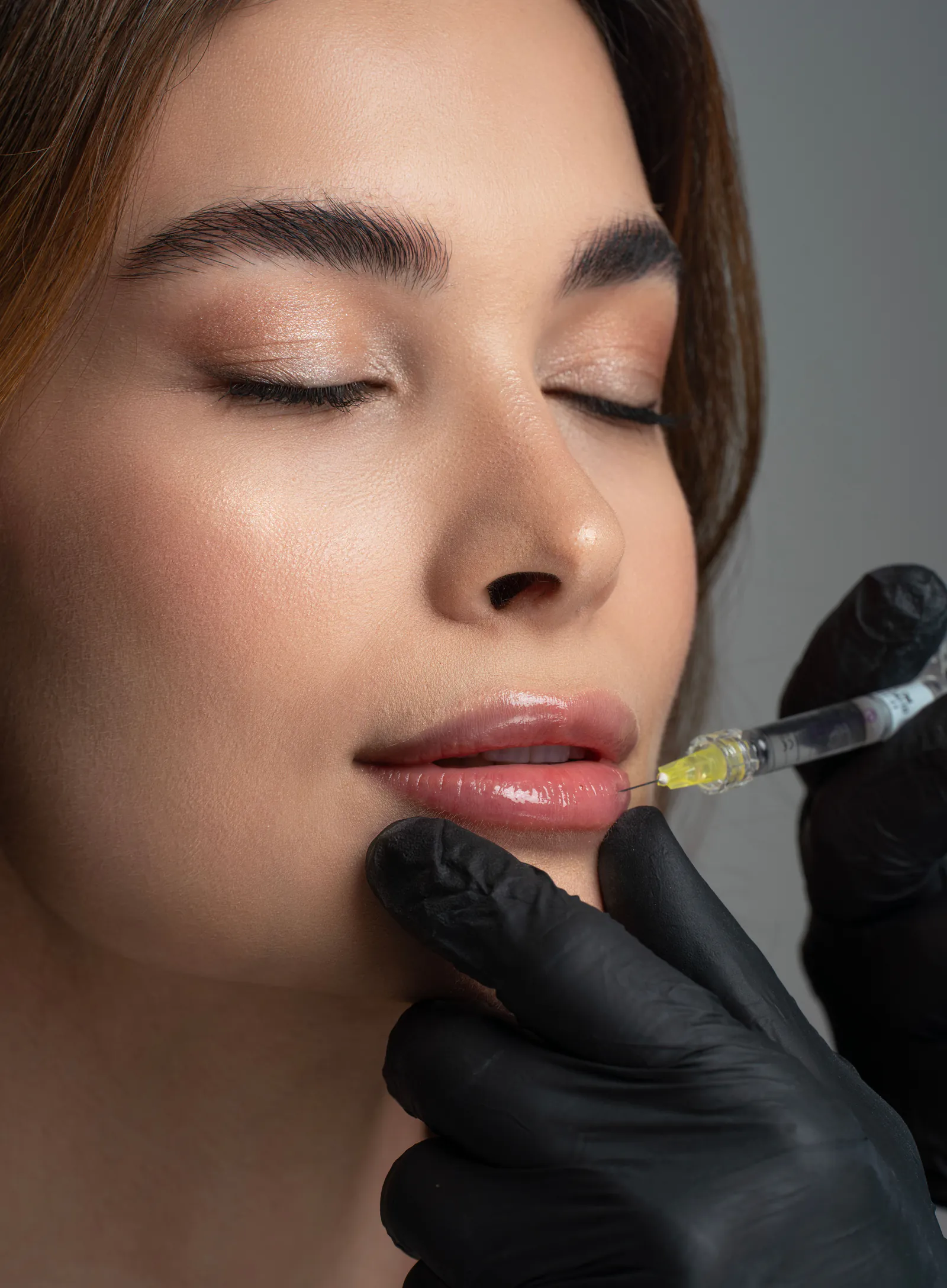 Close-up of a clinician administering a lip-area filler injection in a clinical setting.
