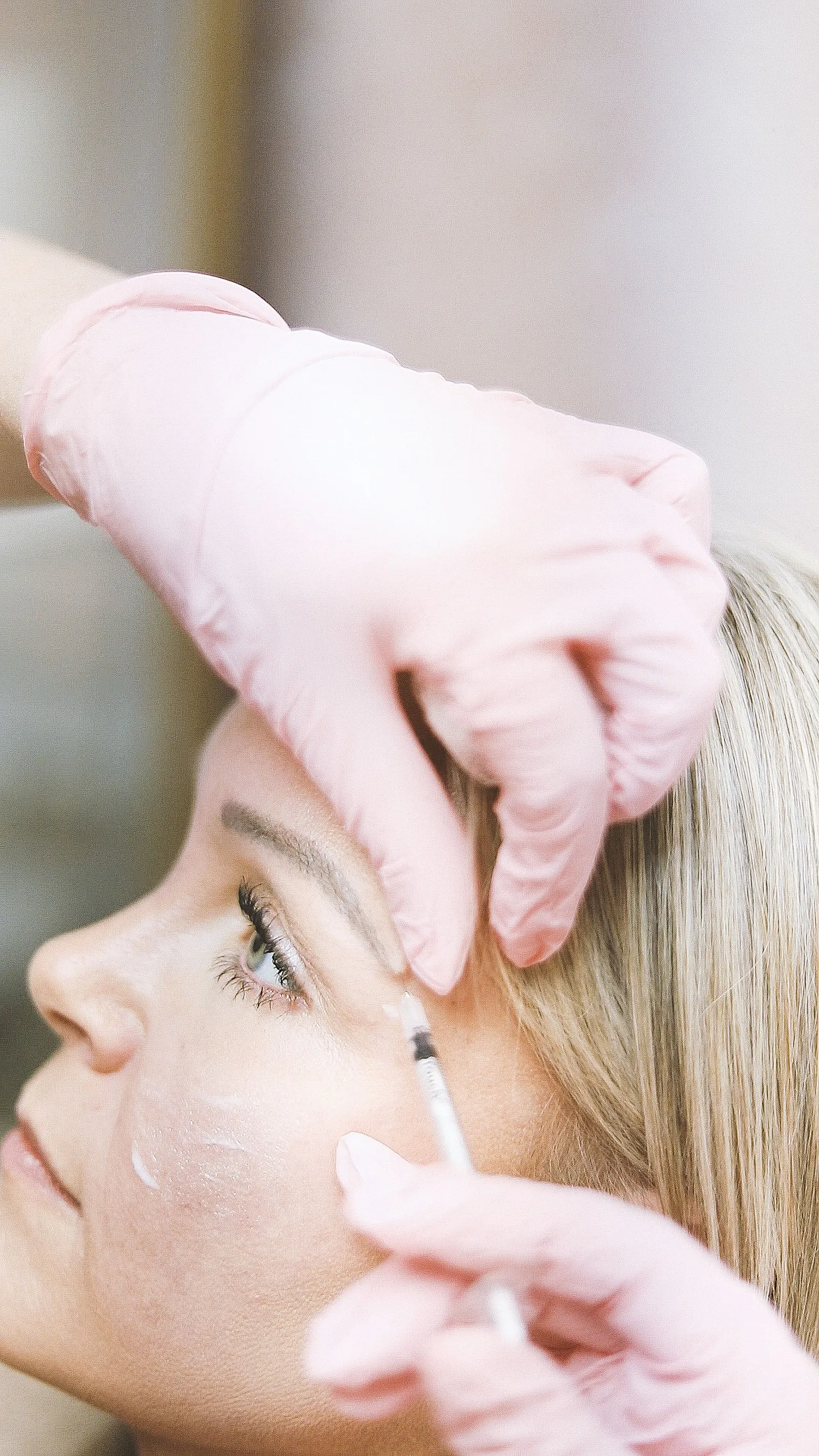 Close-up of a clinician administering an injectable skin treatment at the temple area in a clinical setting.