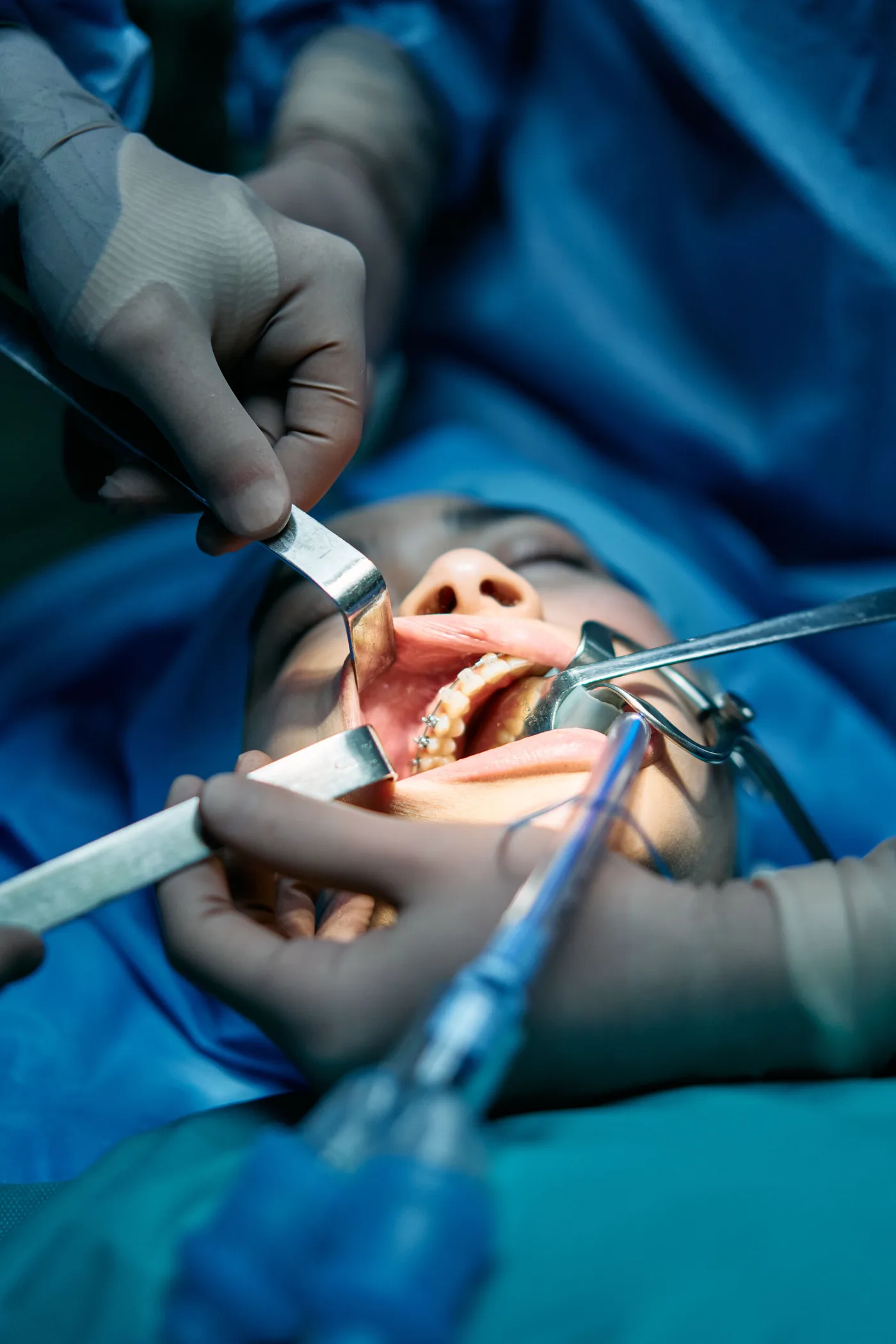 Dental clinician preparing a patient for oral surgery care in a clinical setting.