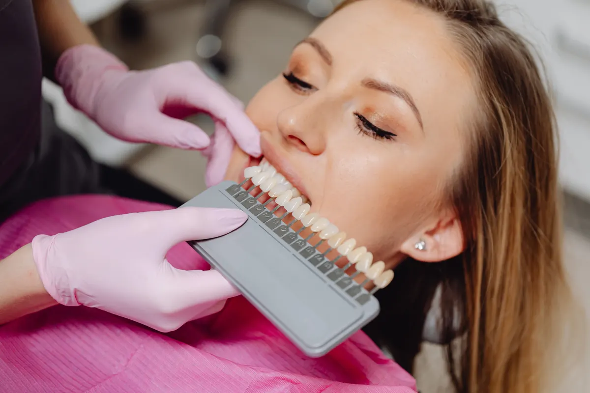 Dental shade tabs being held near a patient's teeth to compare tooth colour.
