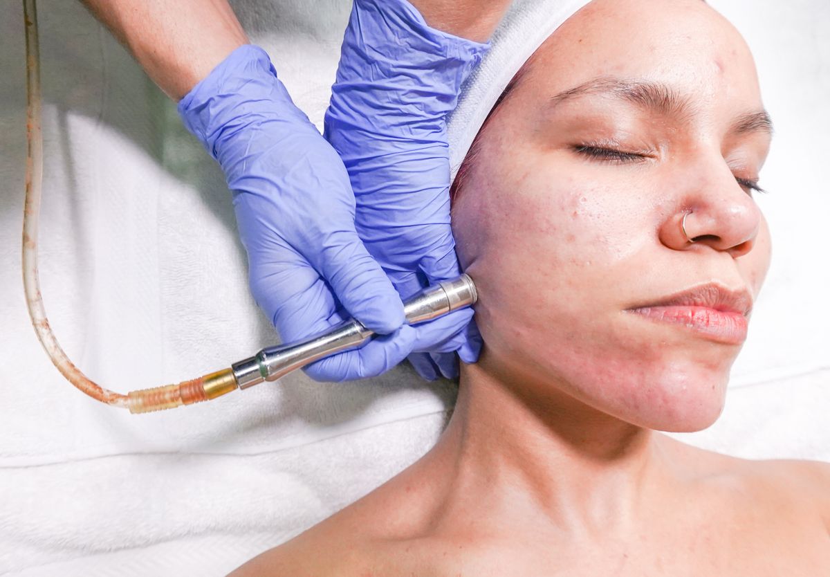 Professional facial skin treatment; illustrative stock image.