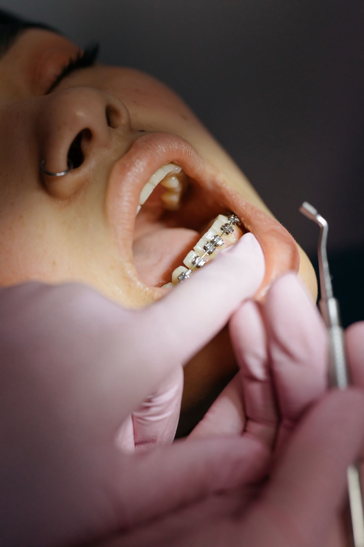 Dentist examining a patient's braces; illustrative stock image.