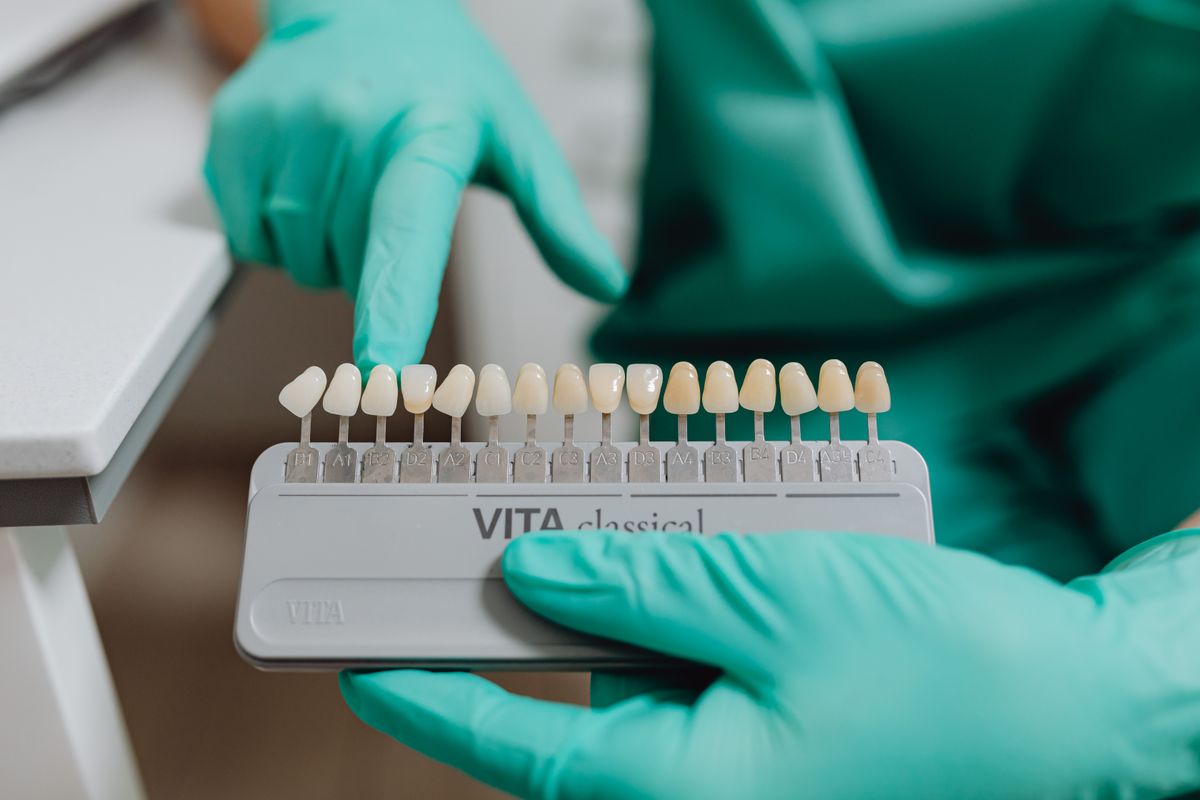 Gloved dental professional holding a tooth shade guide.